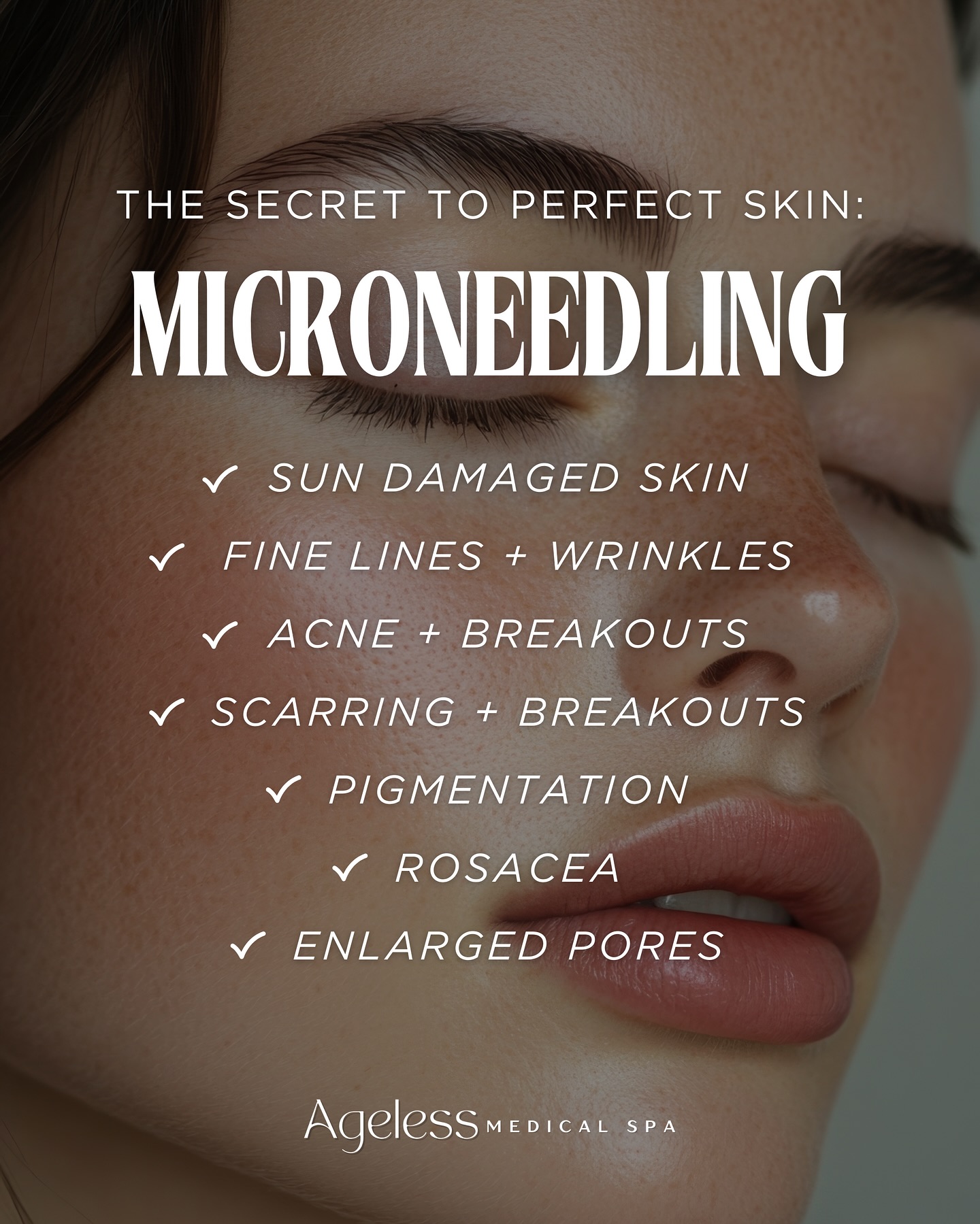 Ready for a skin makeover? Microneedling is your answer!✨ Call us today to schedule your appointment or free consult🫶