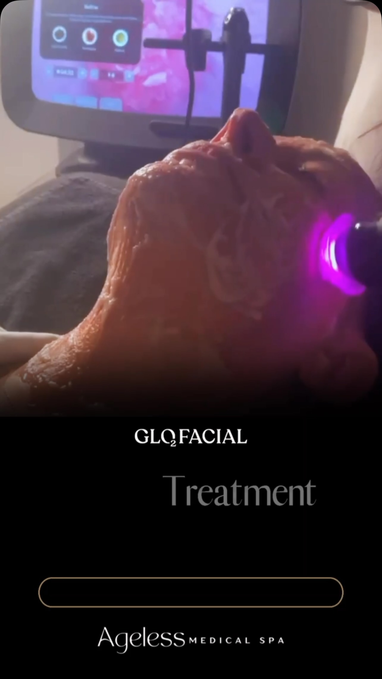 The facial we love for clients who want their skin to look smoother, clearer, and more refined. Call Ageless today to book your appointment and leave with a glow you can see✨