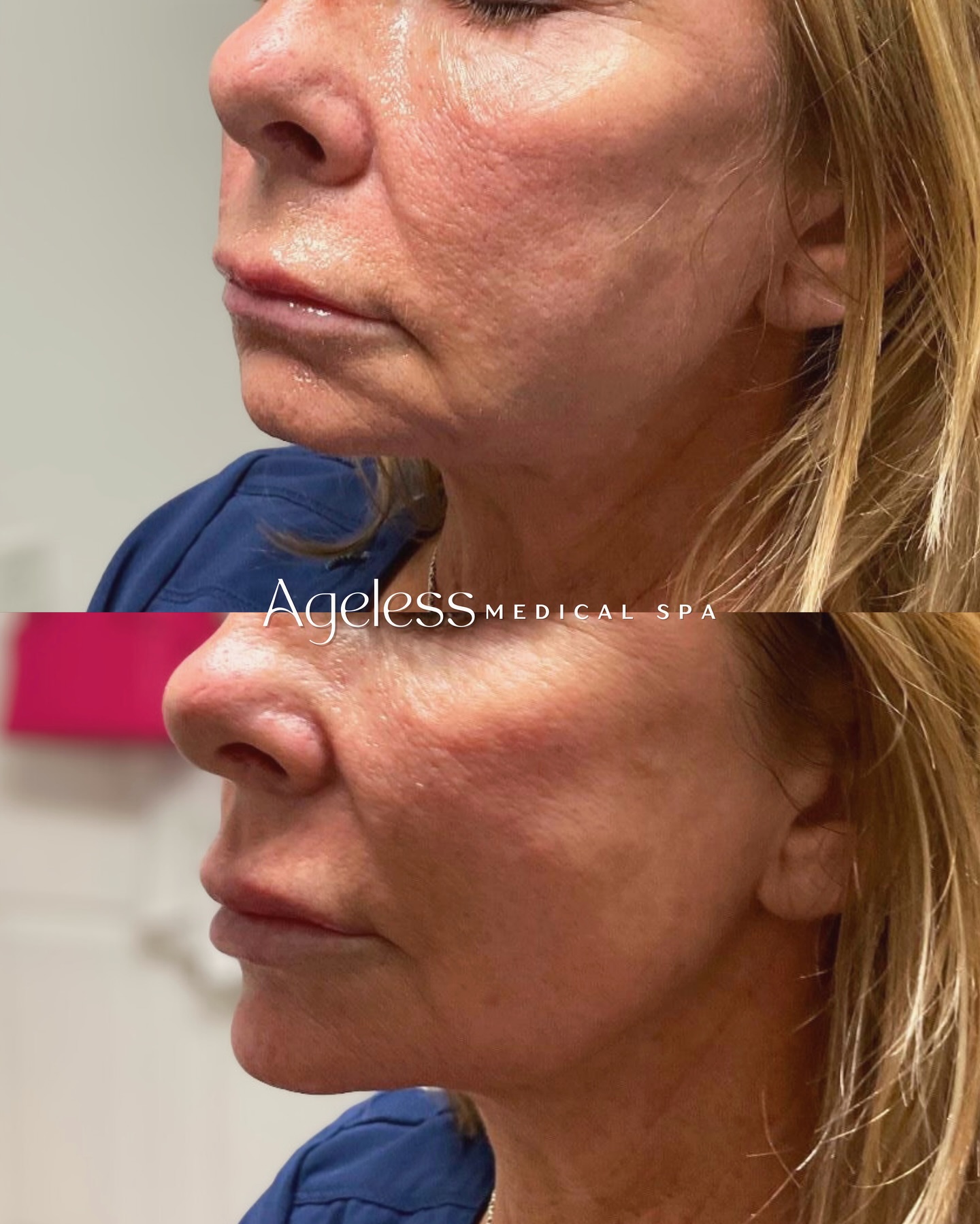 Small tweaks, big results✨ Imagine what your “after” could look like👀 Call or message us to book your FREE consult at Ageless today📞