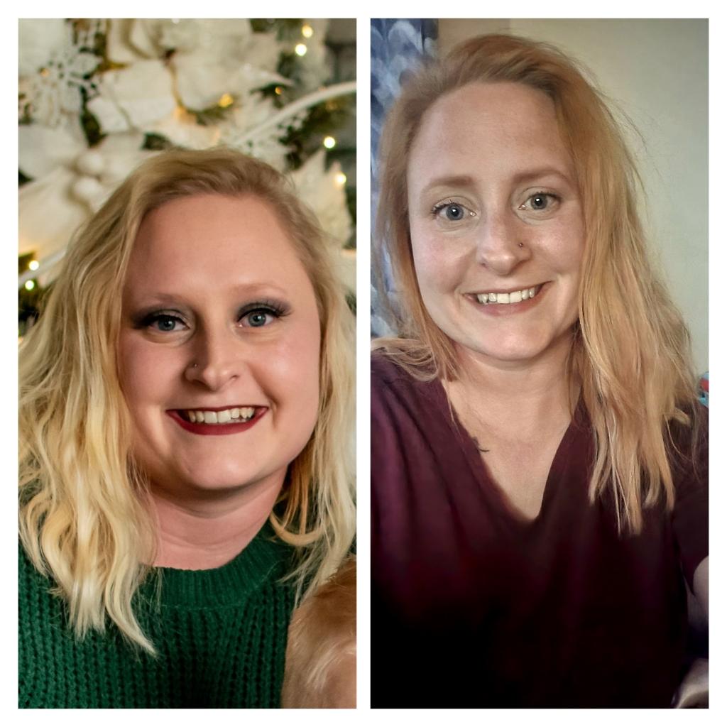 Weight Loss Gallery Ageless Medical Spa