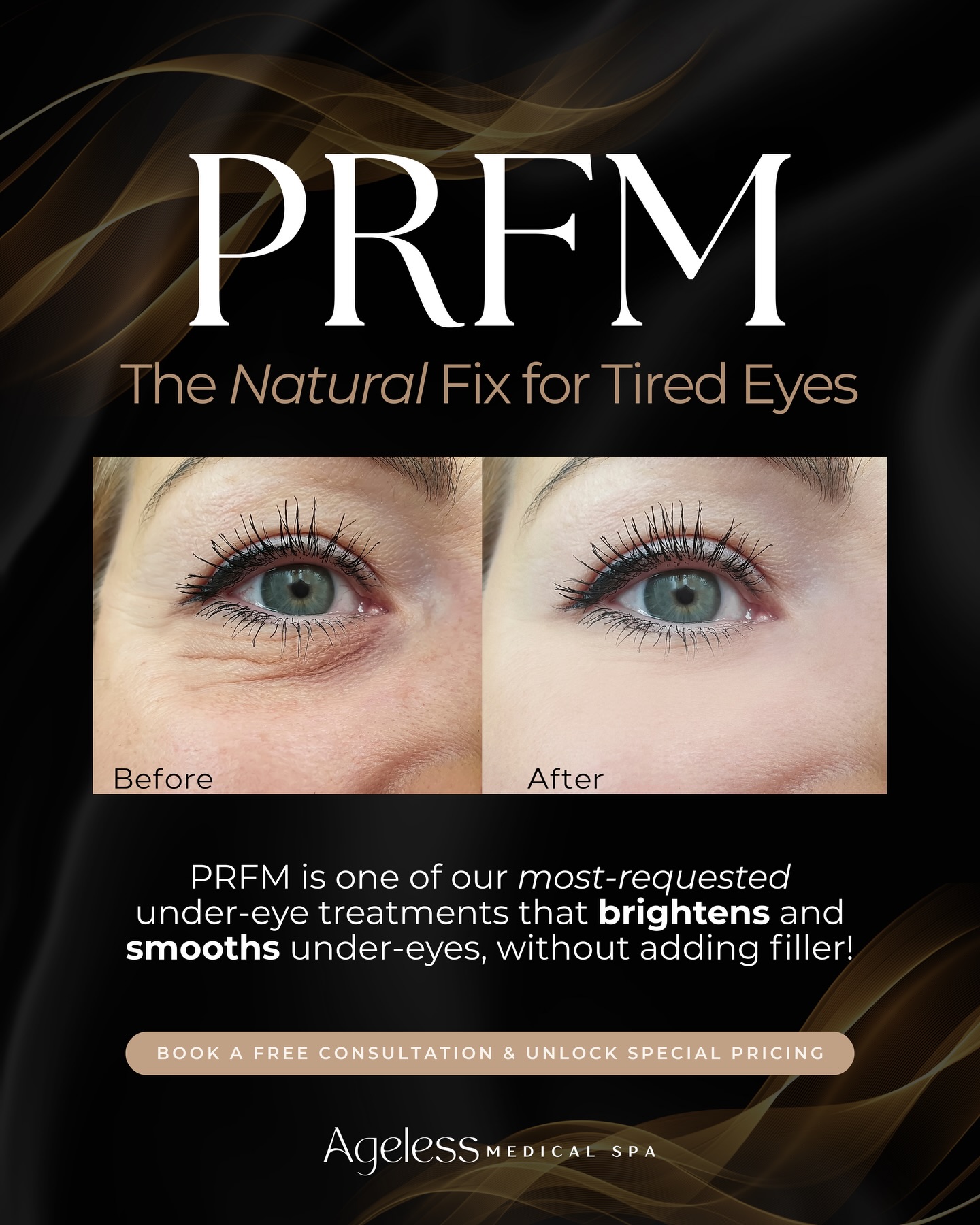 Hollow under eyes, crepey texture, and dark circles don’t stand a chance. PRFM works with your own body to rebuild collagen where you need it most✨