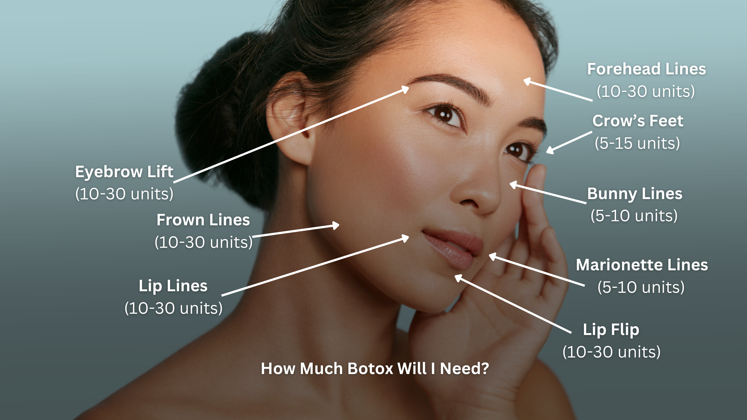 Botox unit recommendations