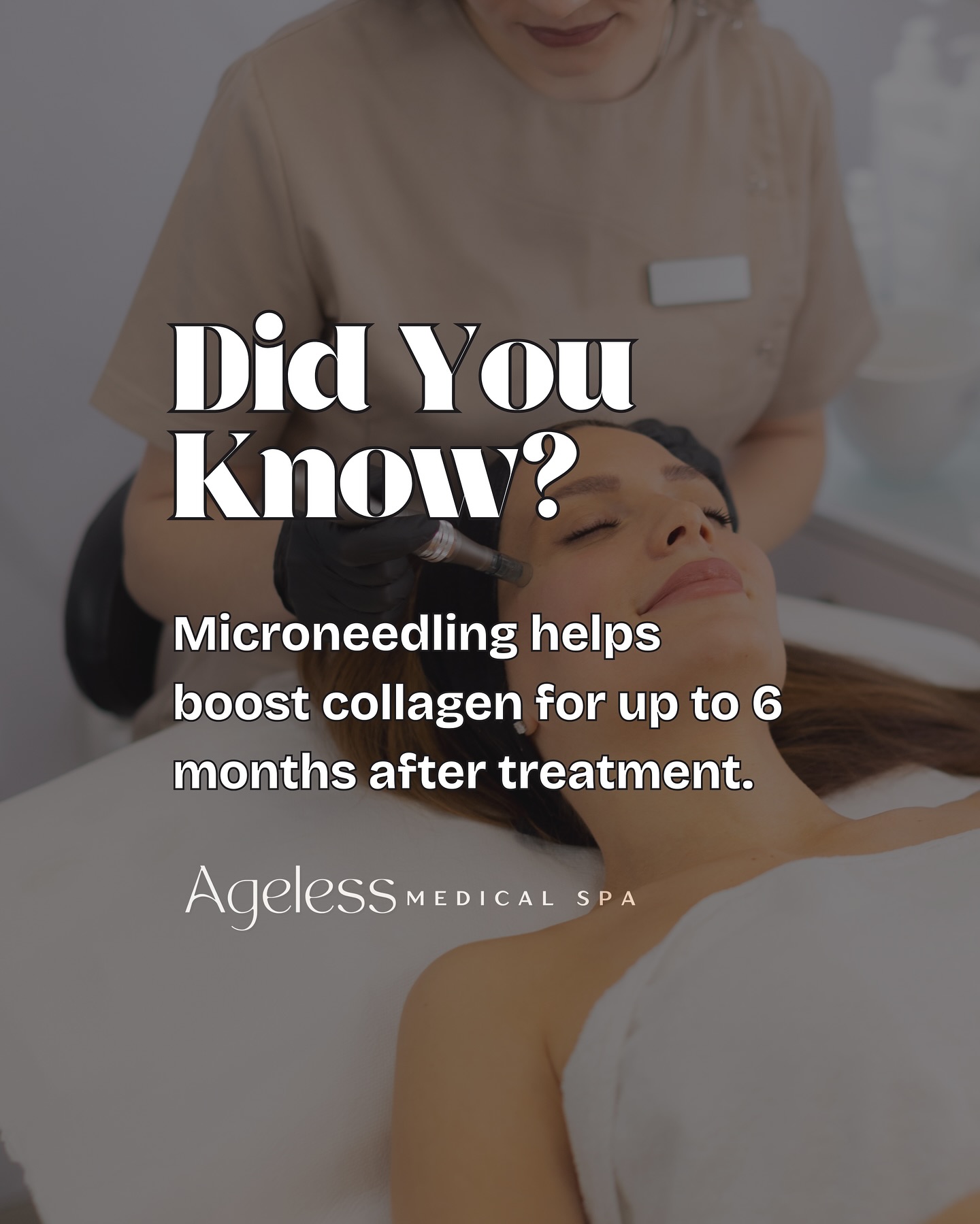 Microneedling isn’t just an instant glow-up👏 It keeps working its magic up to 6 months after a treatment! Book your appointment today and discover the long lasting benefits of Microneedling✨