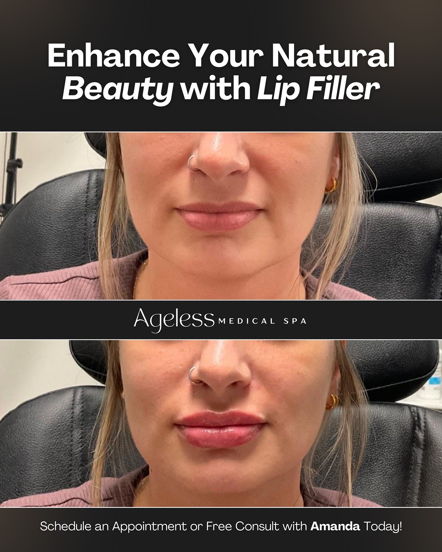 Radiate confidence with plump, defined lips that enhance your entire look✨ Schedule your appointment or free consult with Amanda today💋